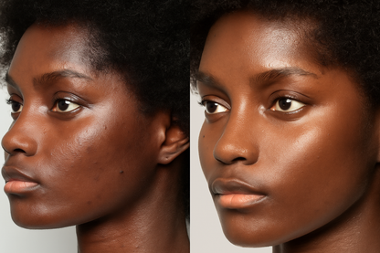 SkinBeauté 5-en-1 – Le Secret d’une Peau Éclatante, Douce et Rayonnante